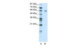 ZNF312 Rabbit anti-Human, Polyclonal, Novus Biologicals 0.1 mL | Buy Online | Novus Biologicals | Fisher Scientific